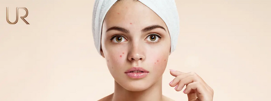 Resist The Urge To Skip The Purge: The Healing Has Begun