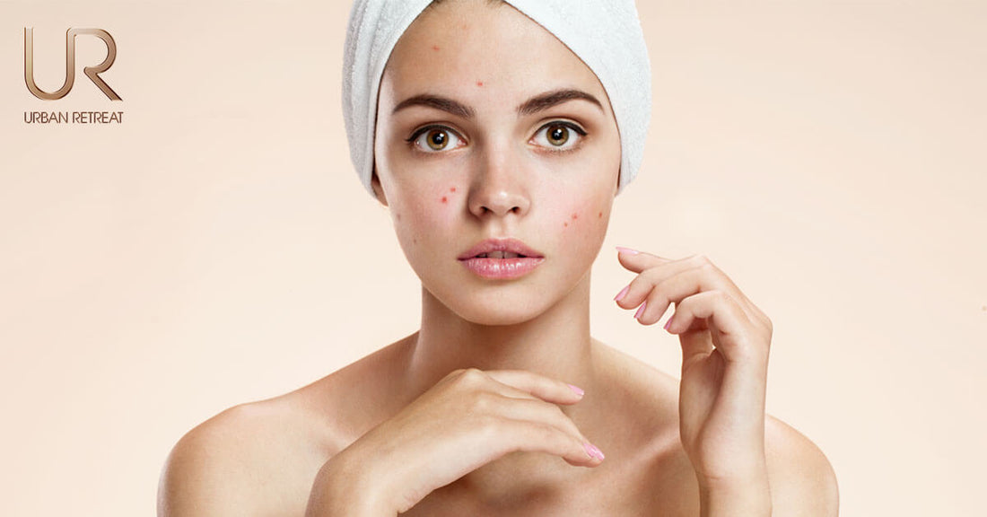 Woman with a white towel on her head, posing with a soft expression.