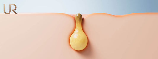 Illustration of a pore acne and skin health